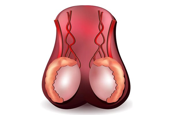 hipogonadismo masculino​